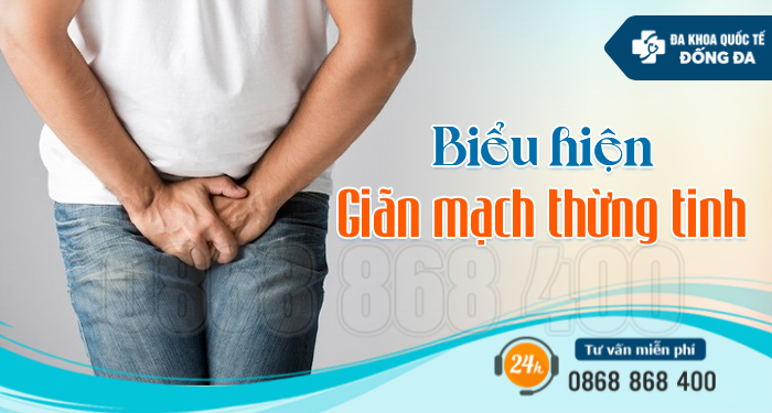 biểu hiện giãn tĩnh mạch thừng tinh