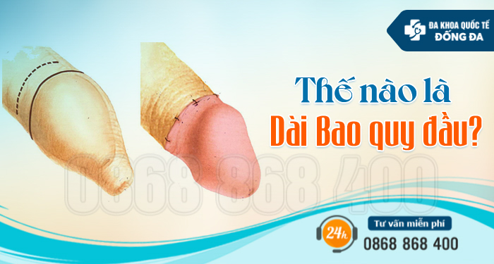 Phát hiện kịp thời và chữa trị dài bao quy đầu