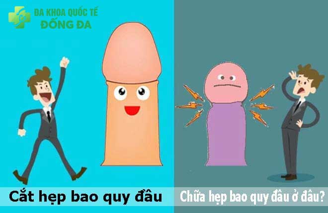 ĐỊA CHỈ UY TÍN CHỮA HẸP BAO QUY ĐẦU TẠI HÀ NỘI·