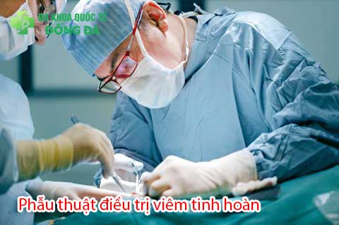 Có cần phẫu thuật để chữa viêm tinh hoàn