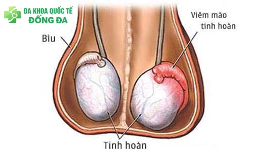 viem-tinh-hoan