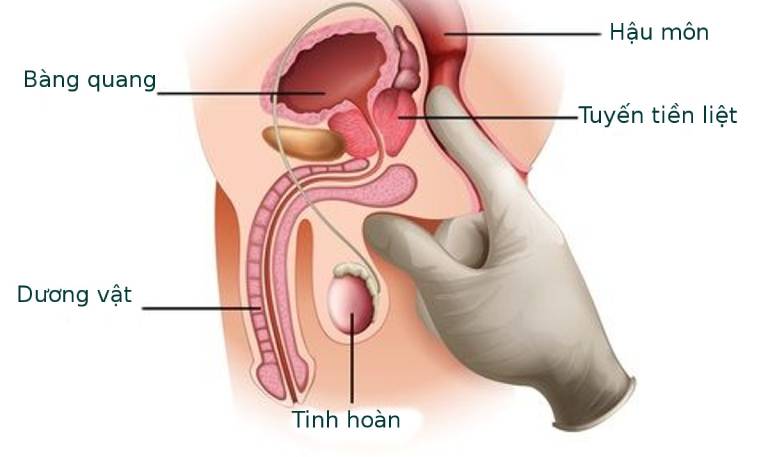 nang-tuyen-tien-liet