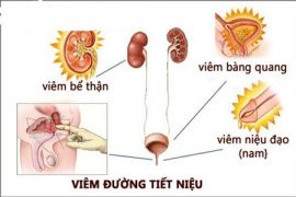 Tiểu rắt dẫn đến viêm đường tiết niệu